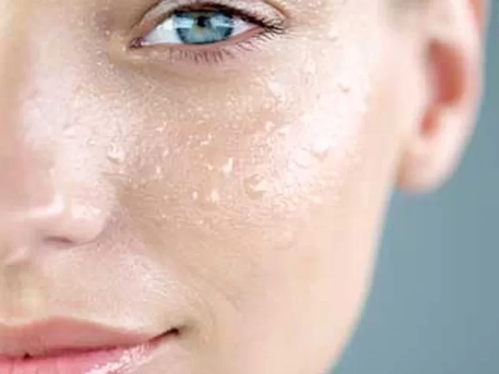 Pieles Grasas 700x525